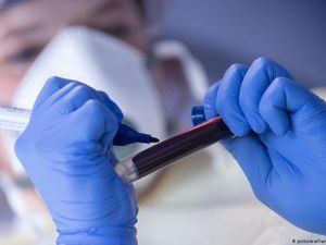 Sejauh Mana Kegunaan Tes Antibodi Massal Virus Corona?