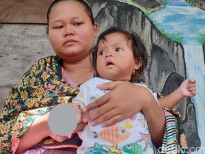 Dokter Hewan UGM Duga Balita Tsamara Bukan Digigit Kutu Kucing Tapi Pinjal Dokter Hewan UGM Duga Balita Tsamara Bukan Digigit Kutu Kucing Tapi Pinjal