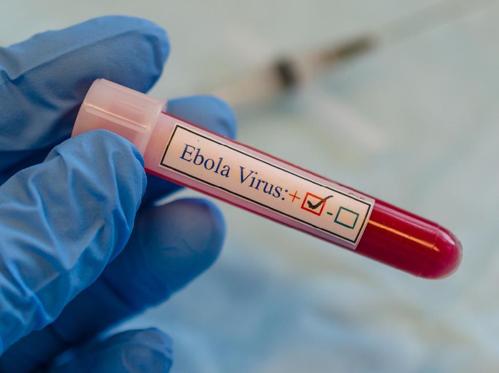 Wabah Ebola Muncul Lagi, 3 Orang di Guinea Meninggal