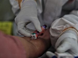 Pasutri Asal Lhokseumawe Positif Corona, Riwayat Perjalanan Ditelusuri Pasutri Asal Lhokseumawe Positif Corona, Riwayat Perjalanan Ditelusuri