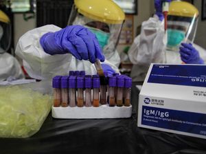 Ada 258 Kasus Baru di Jakarta Jelang Berakhirnya PSBB Transisi