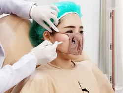 Unik, Klinik Kecantikan di Thailand Bikin Masker Mini untuk Rawat Wajah Klien