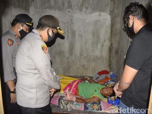 Kembang Api Meledak, Jemari Pria di Pasuruan Hancur