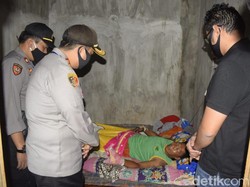 Kembang Api Meledak, Jemari Pria di Pasuruan Hancur