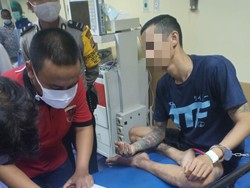 Pria Pembakar Kakak Kandung Jadi PDP Corona, Ini Langkah Dinkes Cianjur