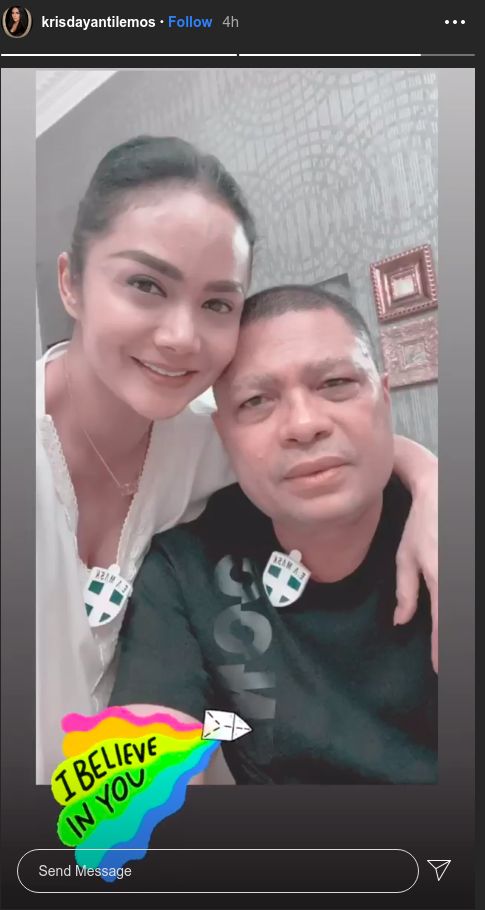 Krisdayanti