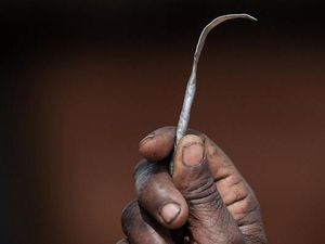 Dokter dan Ayah yang Tersangkut Kasus Sunat Perempuan Dibawa ke Meja Hijau