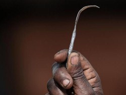 Dokter dan Ayah yang Tersangkut Kasus Sunat Perempuan Dibawa ke Meja Hijau