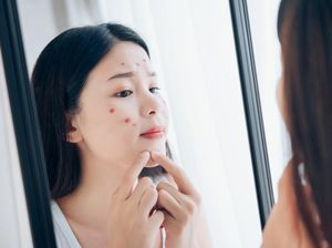 10 Obat Jerawat yang Bisa Bantu Bikin Muka Kinclong 10 Obat Jerawat yang Bisa Bantu Bikin Muka Kinclong