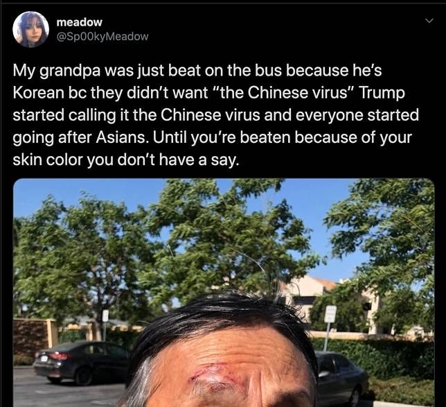 viral