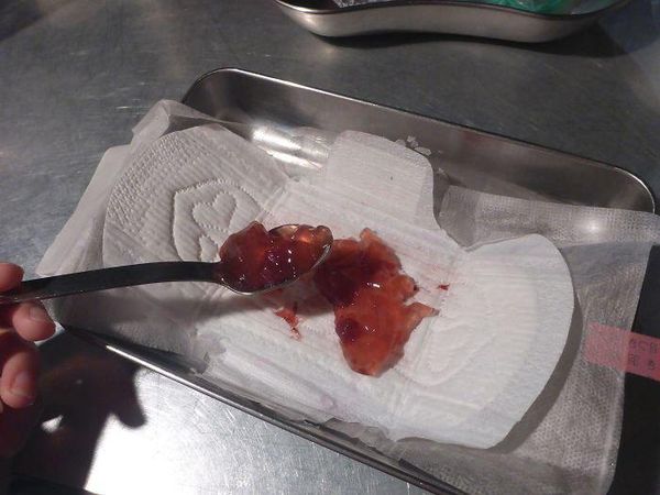 Aneh! 10 Makanan Ini Disajikan dengan Cara Tak Wajar