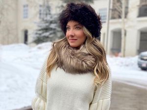 Miris, Miss Universe Colombia Diamputasi Setelah Temukan Benjolan di Perut