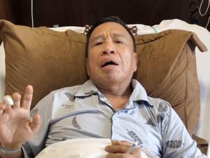 Membaik Usai Operasi Batu Empedu, Miing Bagito Sudah Pulang ke Rumah Membaik Usai Operasi Batu Empedu, Miing Bagito Sudah Pulang ke Rumah
