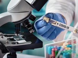 Viral Trombosis Jadi Penyebab Utama Kematian COVID-19, Benarkah?