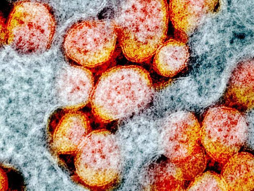 7 Ancaman Berbahaya Selain COVID-19, dari Disease X hingga Virus Nipah