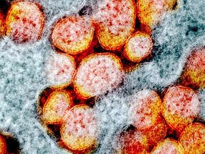 7 Ancaman Berbahaya Selain COVID-19, dari Disease X hingga Virus Nipah 7 Ancaman Berbahaya Selain COVID-19, dari Disease X hingga Virus Nipah