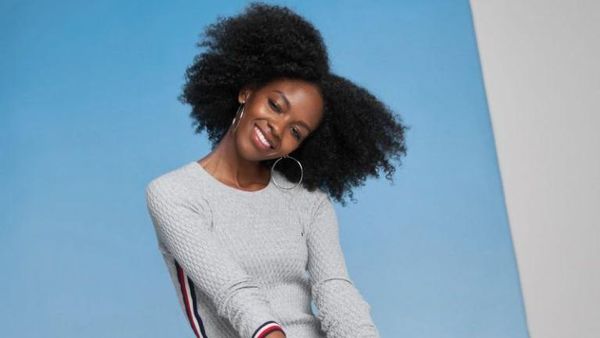 Potret Menawan Model Vogue yang Kehilangan Sebelah Kaki karena Ditabrak