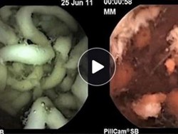 Proses Cerna Mie Instan hingga Tudingan Logo Gratis Geprek Bensu