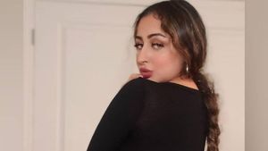 Foto: Selebgram India Ini Obsesi Mirip Kim K, Oplas Mencapai Rp 800 Juta