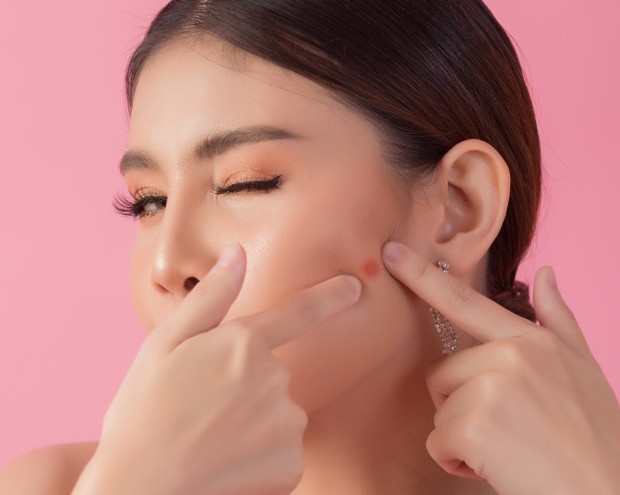 sunflower oil bersifat non-comedigenic yang membantu memerangi jerawat yang menggangu di wajah.