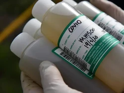 Terungkap, Virus Corona Sudah Ada di Italia Sejak Desember 2019