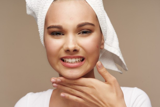 Pertanda Jerawat Sembuh/Freepik.com Penyebab Jerawat Gatal