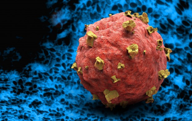 Meningkatkan risiko kanker/freepik.com/GiovanniCancemi Risiko kanker dapat meningkat apabila mengonsumsi protein secara berlebih