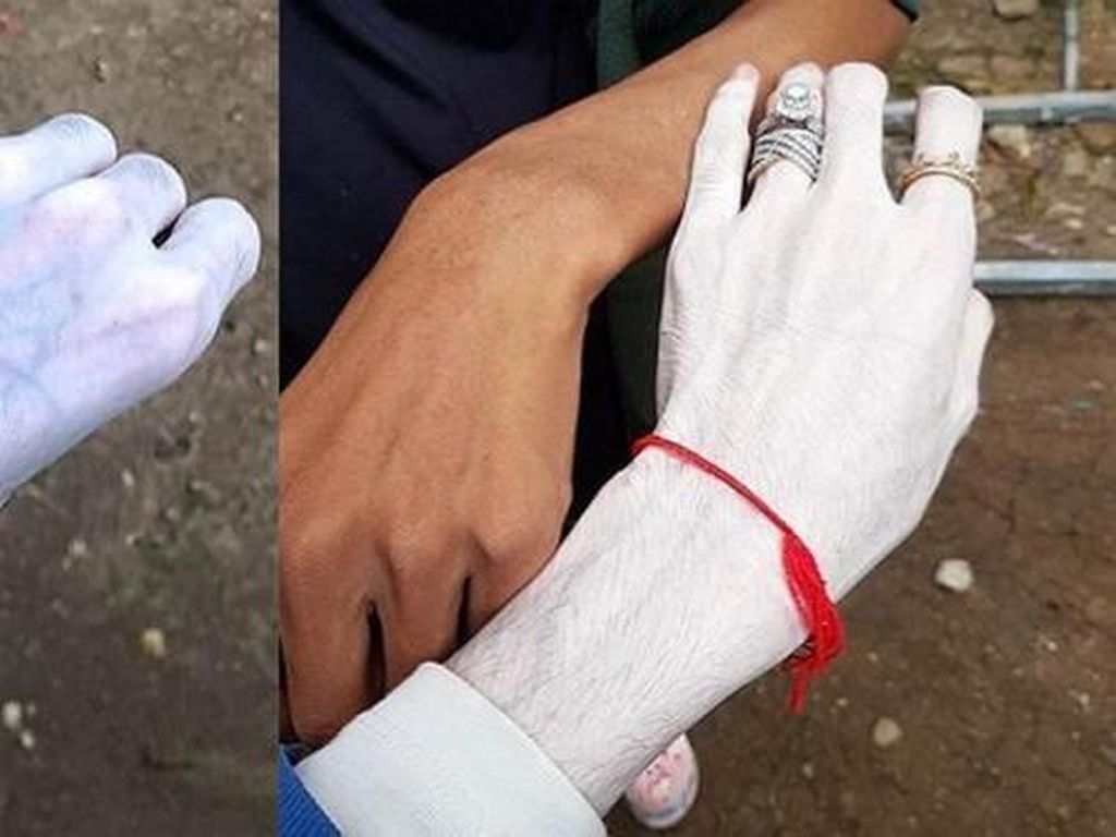Jadi Kontroversi, Krim Pemutih Viral Setelah Penjual Unggah Foto Bikin Syok Jadi Kontroversi, Krim Pemutih Viral Setelah Penjual Unggah Foto Bikin Syok