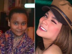 Bikin Pangling! Ini Penampilan Dinda Shafay Dulu dan Sekarang