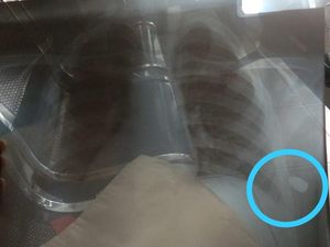 Guyon Bocah Ditepuk Setan Rupanya Kena Peluru Nyasar di Badan Guyon Bocah Ditepuk Setan Rupanya Kena Peluru Nyasar di Badan