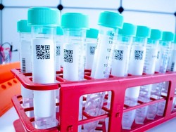 Diikuti 14 Ribu Orang, Inggris Uji Coba Tes Corona dengan Air Liur