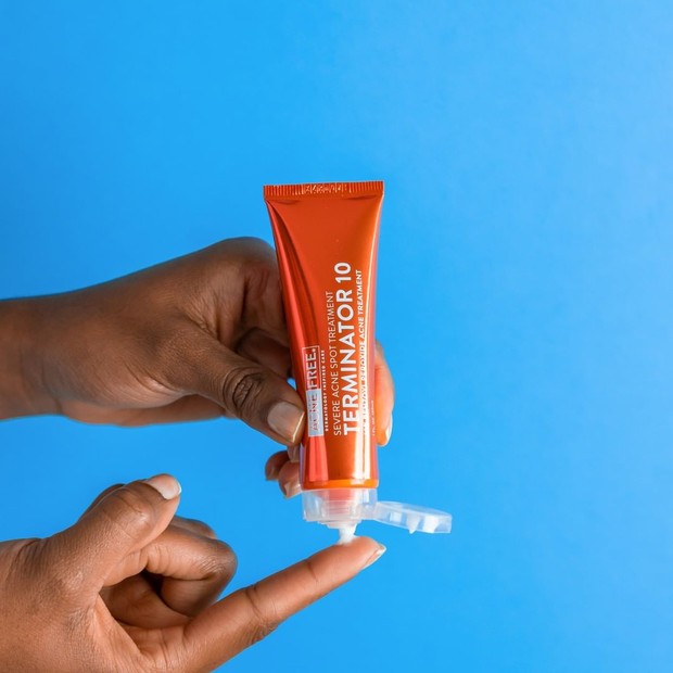 AcneFree Terminator 10 mengandung 10 persen mikro-benzoil peroksida yang mampu menghilangkan jerawat.