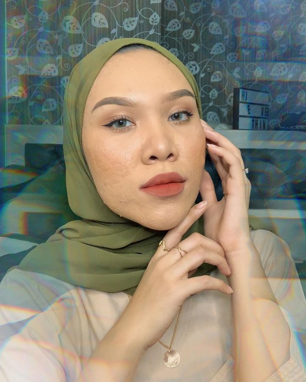 Cut Rizky nyatanya memiliki masalah jerawat yang cukup memprihatinkan. Bahkan perempuan yang akrab disapa Kak Syut ini mengklaim dirinya sebagai perempuan yang berjerawat setiap hari