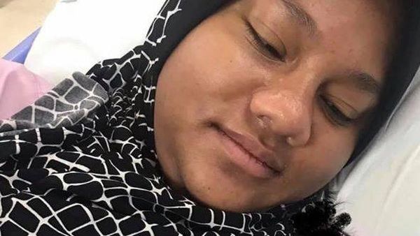 Foto Perubahan Drastis Wajah Wanita Saat Hamil Vs Usai Melahirkan