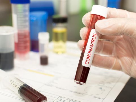 Doctors looking after infected patients in hospital, coronavirus concept.