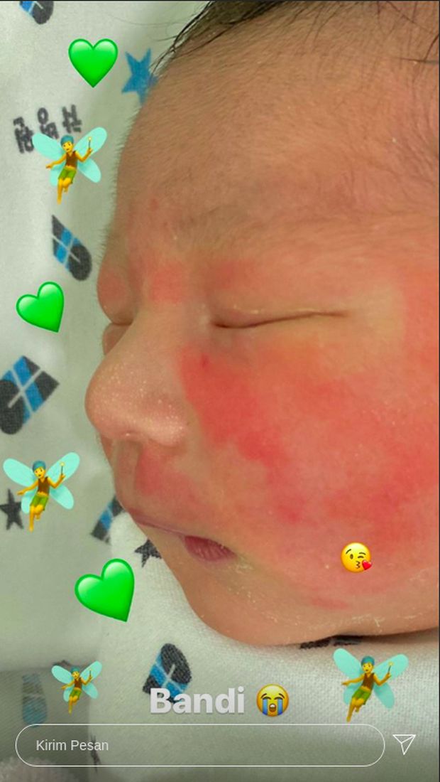 Selamat, Hyuna Eks Nine Muses Lahirkan Anak Pertama