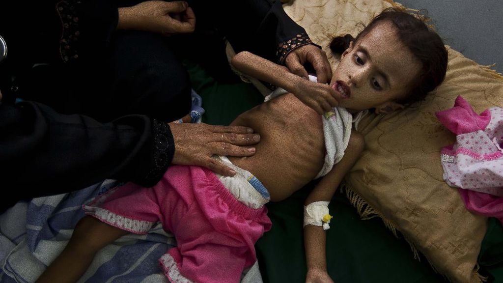 Potret Anak-anak Yaman yang Terancam Kelaparan Potret Anak-anak Yaman yang Terancam Kelaparan
