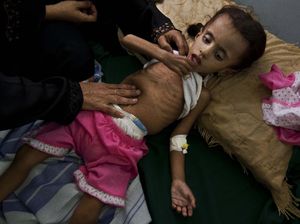 Potret Anak-anak Yaman yang Terancam Kelaparan