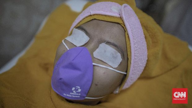 Pasien saat melakukan perawatan kulit wajah di salah satu klinik kecantikan di kawasan Manggarai, Jakarta, Sabtu, 27 Juni 2020. Perawatan wajah dengan protokol kesehatan tetap menjadi prioritas klinik kecantikan guna mengantisipasi penularan COVID-19. CNN Indonesia/Bisma Septalisma