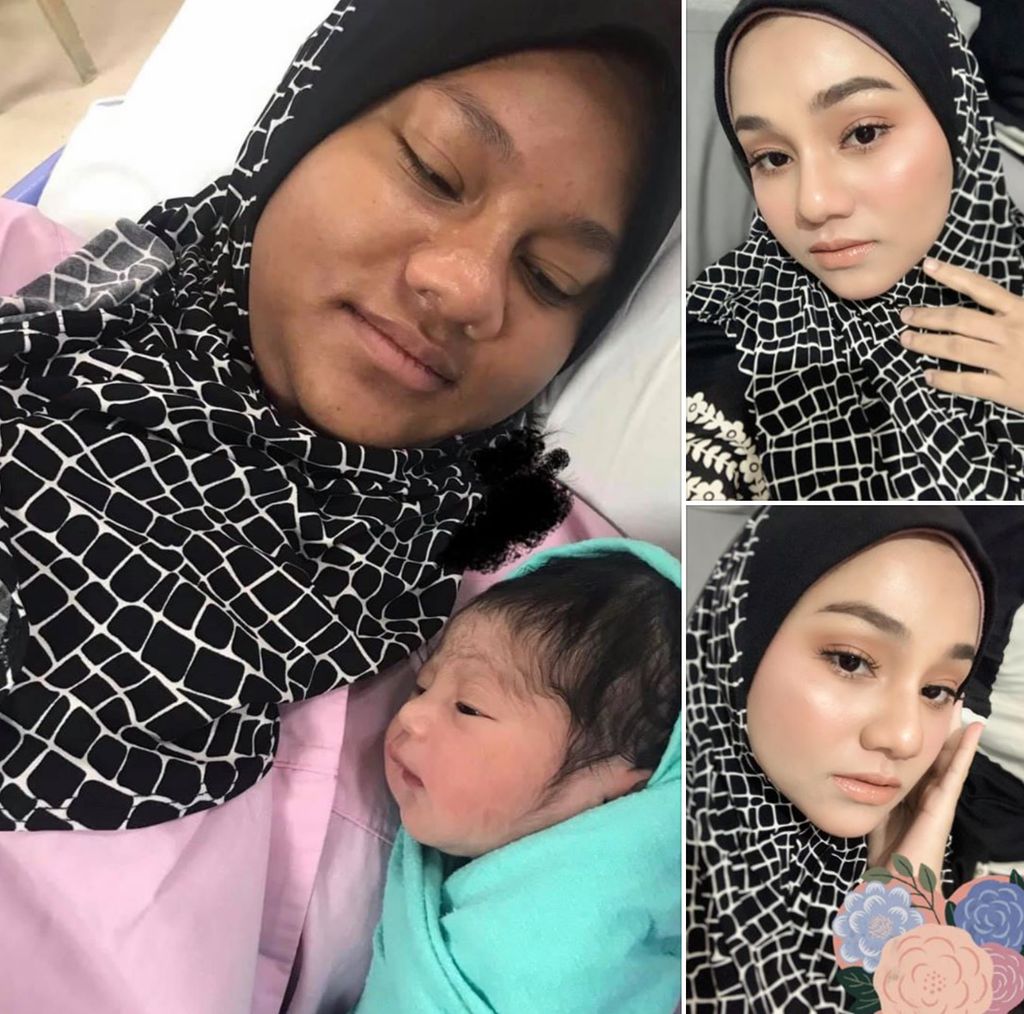 Wajah Berubah Drastis Saat Hamil, Wanita Cantik Ini Malu Unggah Foto di FB