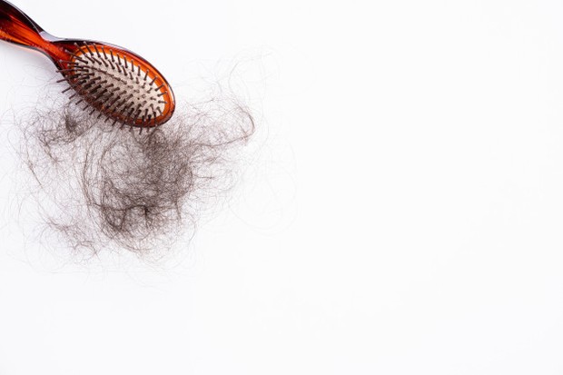 Masalah kerusakan rambut yang paling banyak dialami oleh wanita maupun pria.