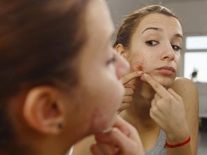 Agar Tak Jerawatan Saat Pakai Masker, Ini Tips Jenius dari Dokter Kulit Agar Tak Jerawatan Saat Pakai Masker, Ini Tips Jenius dari Dokter Kulit