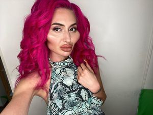 Wanita dengan Pipi Terbesar Belum Puas dengan Penampilan, Jalani Oplas Ini Wanita dengan Pipi Terbesar Belum Puas dengan Penampilan, Jalani Oplas Ini