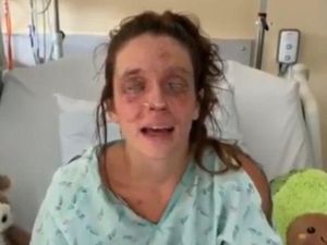 Wanita Ini Berakhir Buta saat Coba Bikin Kosmetik Sendiri di Rumah