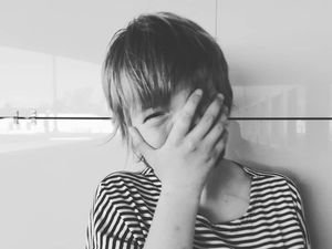 Kisah Gadis Berwajah Setengah, Ingin Cari Ayah yang Mencampakannya