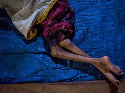 Corona Berisiko Tingkatkan Masalah Gizi Pada Anak