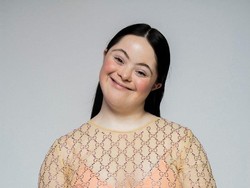 Inspiratif, Remaja Down Syndrome Jadi Model Gucci dan Vogue