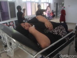 Berbobot 145 Kg, Perempuan Ini Dirawat di RSUD Sumedang