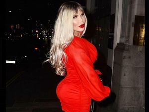 Pria yang Tergila-gila Oplas Kini Jadi Transgender Umumkan Ubah Nama