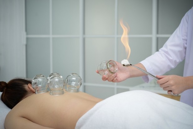 Terapi bekam/ Foto: Freepik.com manfaat bekam di antaranya dapat melancarkan sistem pencernaan